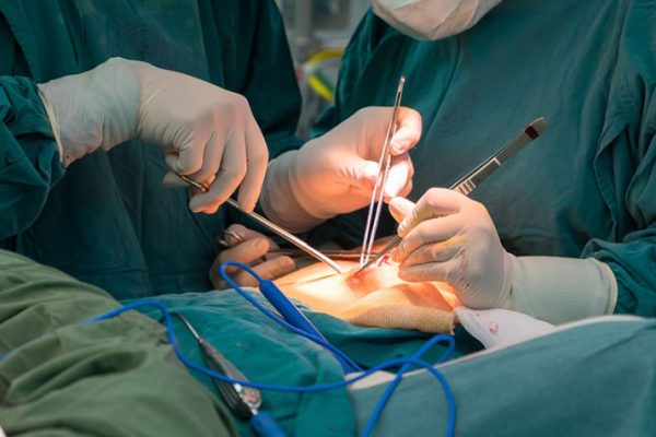 General-Surgery-in-mogadishu-somalia